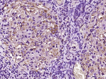 B4GALT2 Rabbit Polyclonal Antibody