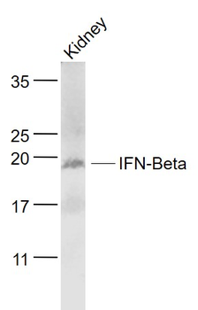 IFNB1 Rabbit Polyclonal Antibody