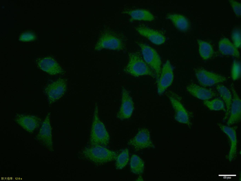 Vinculin Rabbit Polyclonal Antibody