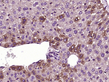 SLC25A41 Rabbit Polyclonal Antibody