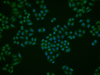 Beta-arrestin 2 Rabbit Polyclonal Antibody