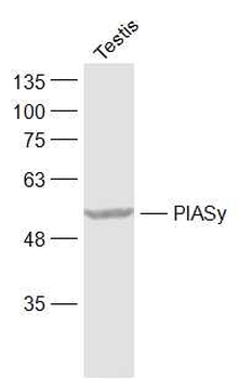 PIAS4/PIASy Rabbit Polyclonal Antibody