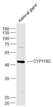 CYP11B2 Rabbit Polyclonal Antibody