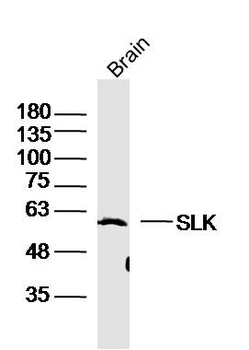 SLK Rabbit Polyclonal Antibody