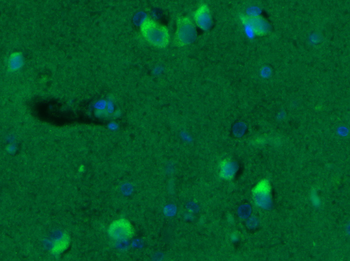 GABA A Receptor gamma 2 Rabbit Polyclonal Antibody