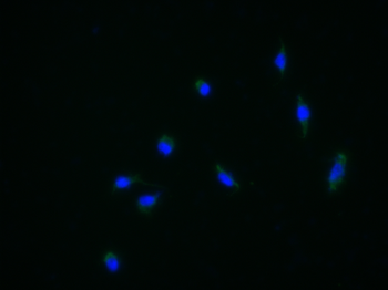 GABA A Receptor gamma 2 Rabbit Polyclonal Antibody