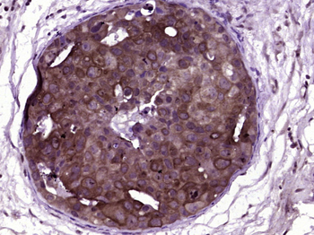 GCDGP15 Rabbit Polyclonal Antibody