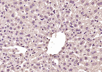 GKRP Rabbit Polyclonal Antibody