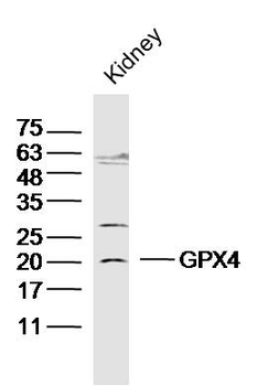 GPX4 Rabbit Polyclonal Antibody
