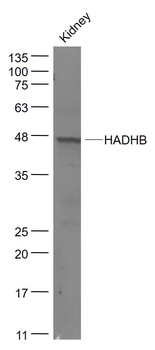 HADHB Rabbit Polyclonal Antibody
