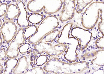 Phospho-GRB10 (Tyr67) Rabbit Polyclonal Antibody