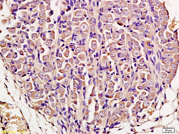 Phospho-GRB10 (Tyr67) Rabbit Polyclonal Antibody