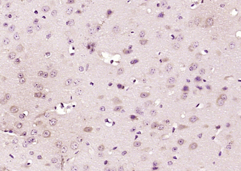 SRD5A1 Rabbit Polyclonal Antibody