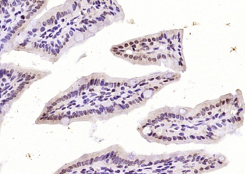 Cofilin Rabbit Polyclonal Antibody