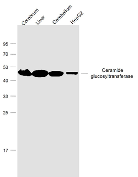 Ceramide glucosyltransferase Rabbit Polyclonal Antibody