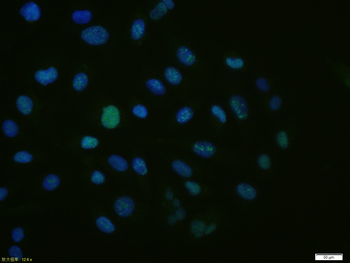 Cyclin E1 Recombinant Rabbit Monoclonal Antibody
