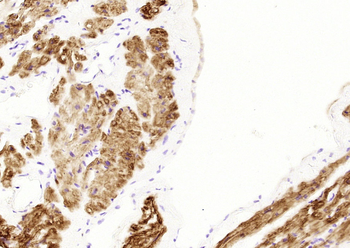 Desmin (ready to use) Mouse Monoclonal Antibody