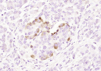 IGF2BP2 Rabbit Polyclonal Antibody