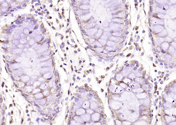 CD163L1 Rabbit Polyclonal Antibody