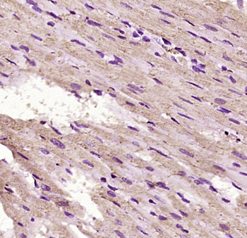 EYA4 Rabbit Polyclonal Antibody