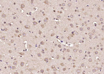 Glypican 1 Rabbit Polyclonal Antibody