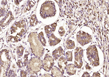 AHR Rabbit Polyclonal Antibody