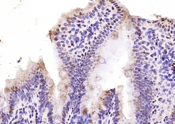 AHR Rabbit Polyclonal Antibody