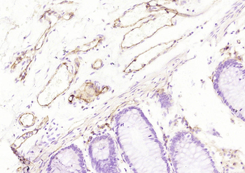 CD31 (ready to use) Mouse Monoclonal Antibody
