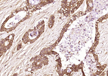 CK II beta Rabbit Polyclonal Antibody