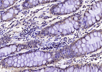 Nm23-H2/NME2 Rabbit Polyclonal Antibody