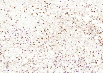 Estrogen Receptor α (ready to use) Mouse Monoclonal Antibody