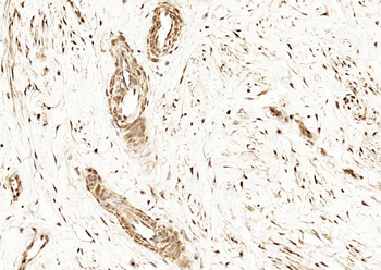 Estrogen Receptor α (ready to use) Mouse Monoclonal Antibody