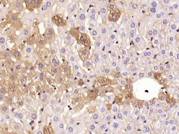 ANGPTL8 Mouse Monoclonal Antibody