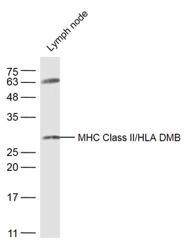 HLA-DPB1 Rabbit Polyclonal Antibody