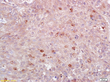 HLA-DPB1 Rabbit Polyclonal Antibody