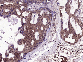 Phospho-HSP70 (Tyr41) Rabbit Polyclonal Antibody