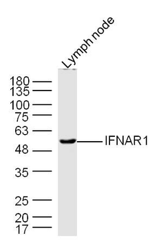 IFNAR1 Rabbit Polyclonal Antibody