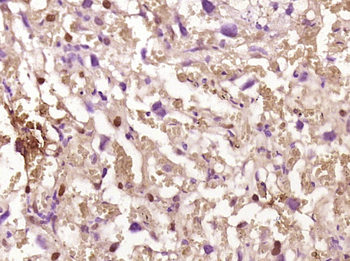 Phospho-IKK beta (Ser471) Rabbit Polyclonal Antibody