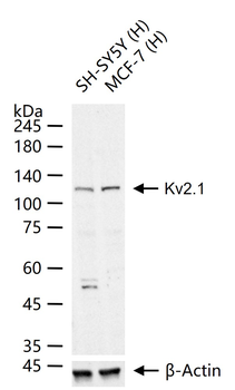Kv2.1 Rabbit Polyclonal Antibody