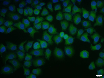 Phospho-Tuberin (Tyr1571) Rabbit Polyclonal Antibody