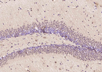 NR2F1/NR2F2 Rabbit Polyclonal Antibody