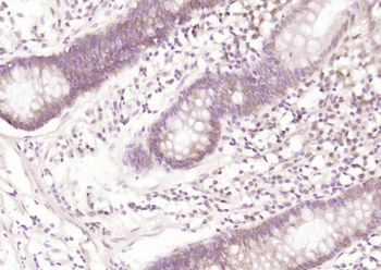 CTNND2/delta 2 Catenin Rabbit Polyclonal Antibody