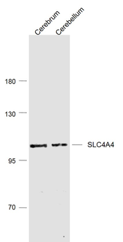 SLC4A4 Rabbit Polyclonal Antibody