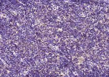 API5 Rabbit Polyclonal Antibody