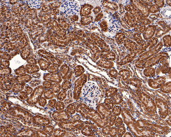 BCL2A1 Recombinant Rabbit Monoclonal Antibody