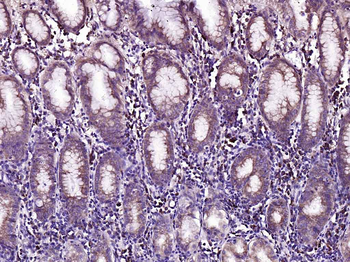 Bad Recombinant Rabbit Monoclonal Antibody