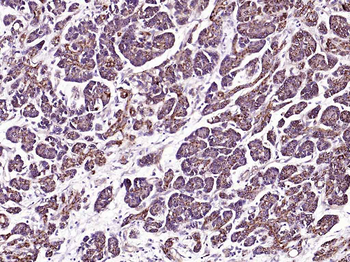 Bad Recombinant Rabbit Monoclonal Antibody