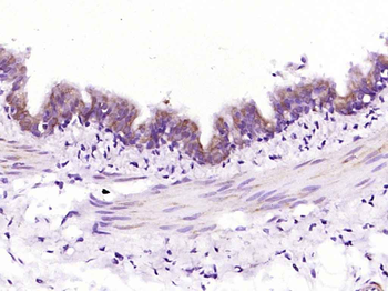 Bad Recombinant Rabbit Monoclonal Antibody