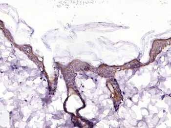 Bad Recombinant Rabbit Monoclonal Antibody