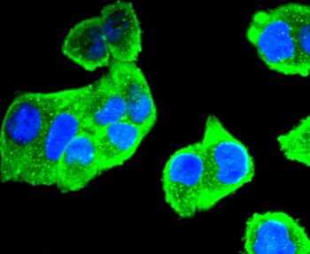 Aurora A Recombinant Rabbit Monoclonal Antibody
